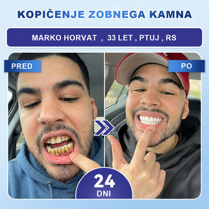 Guxar® Tideglusib Oralni Trakovi 🦷 – Aktivacija matičnih celic🧬, regeneracija dentina💎, krepitev sklenine⚡, beljenje zob✨, zmanjšanje občutljivosti💧, mikronadliki serum za zobe in dlesni💖, nežna vsakodnevna uporaba🌿