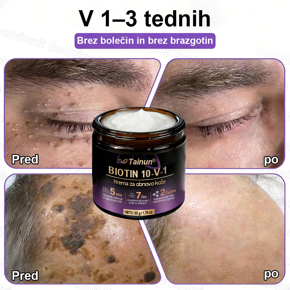 Tainun® Biotin 10-v-1 krema za obnovo kože ✨ proti staranju, luskavici, aknam, brazgotinam, pigmentaciji, suhosti, vnetjem & intimnemu nelagodju 🌿 z naravnimi bioaktivnimi sestavinami 💧 za gladko, čvrsto & mladostno kožo 🌸
