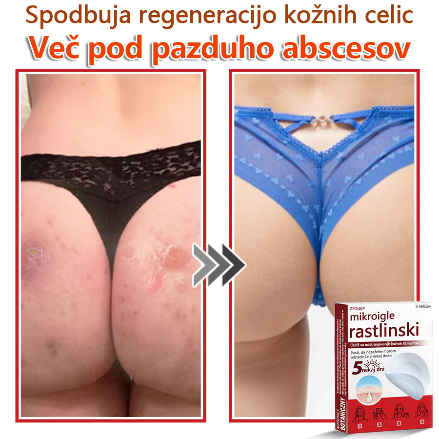 GFOUK® Rastlinski Mikronidling obliži za odstranjevanje kožnih izrastkov✨ – 🩹 Neboleče | 🚫 Brez Brazgotin | 🌿 Naravne Mikroiglice | 🎯 Globinsko Delovanje | 🛡️ Varno za Občutljivo Kožo | 📦 9 kosov | 🇪🇺 Medicinski Razred I |
