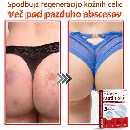 GFOUK® Rastlinski Mikronidling obliži za odstranjevanje kožnih izrastkov✨ – 🩹 Neboleče | 🚫 Brez Brazgotin | 🌿 Naravne Mikroiglice | 🎯 Globinsko Delovanje | 🛡️ Varno za Občutljivo Kožo | 📦 9 kosov | 🇪🇺 Medicinski Razred I |