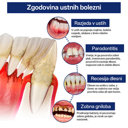 Rtmoy® BeeTakt kapljice za nego zob s čebeljim strupom – napredna rešitev za obnovo dlesni in ustno zdravje 🦷 | odstranjevanje zobnih oblog, regeneracija dlesni in lajšanje občutljivosti