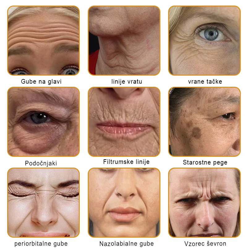 PuraCure® krema za obnovo kože s čebeljim strupom 🐝 | Naravno zdravljenje ekcema, luskavice, dermatitisa in draženja kože | Pomirjujoča in regenerativna formula  🔥
