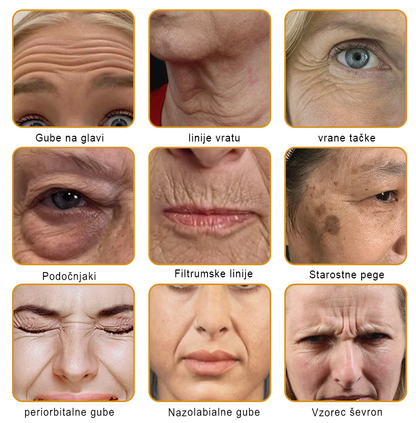 PuraCure® krema za obnovo kože s čebeljim strupom 🐝 | Naravno zdravljenje ekcema, luskavice, dermatitisa in draženja kože | Pomirjujoča in regenerativna formula  🔥