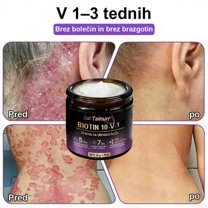 Tainun® Biotin 10-v-1 krema za obnovo kože ✨ proti staranju, luskavici, aknam, brazgotinam, pigmentaciji, suhosti, vnetjem & intimnemu nelagodju 🌿 z naravnimi bioaktivnimi sestavinami 💧 za gladko, čvrsto & mladostno kožo 🌸