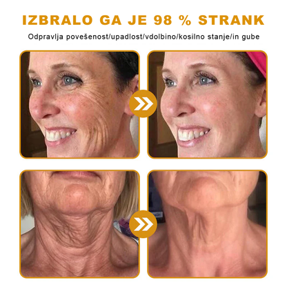 PuraCure® krema za obnovo kože s čebeljim strupom 🐝 | Naravno zdravljenje ekcema, luskavice, dermatitisa in draženja kože | Pomirjujoča in regenerativna formula  🔥