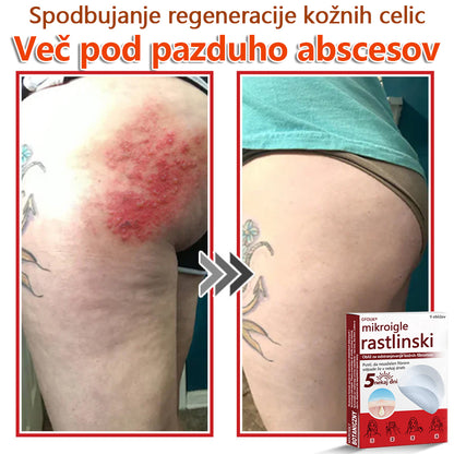 GFOUK® Rastlinski Mikronidling obliži za odstranjevanje kožnih izrastkov✨ – 🩹 Neboleče | 🚫 Brez Brazgotin | 🌿 Naravne Mikroiglice | 🎯 Globinsko Delovanje | 🛡️ Varno za Občutljivo Kožo | 📦 9 kosov | 🇪🇺 Medicinski Razred I |