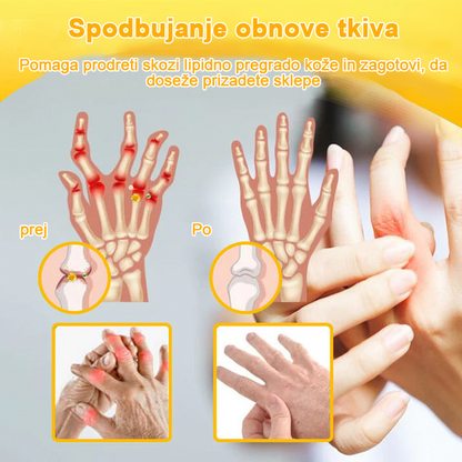 ADNOON™ Krema za lajšanje bolečin in celjenje kosti z botulin toksinom in čebeljim strupom 🦴🐝