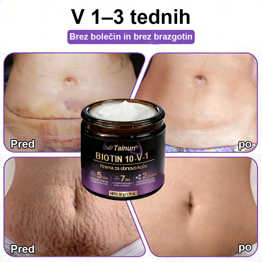Tainun® Biotin 10-v-1 krema za obnovo kože ✨ proti staranju, luskavici, aknam, brazgotinam, pigmentaciji, suhosti, vnetjem & intimnemu nelagodju 🌿 z naravnimi bioaktivnimi sestavinami 💧 za gladko, čvrsto & mladostno kožo 🌸
