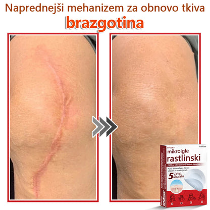 GFOUK® Rastlinski Mikronidling obliži za odstranjevanje kožnih izrastkov✨ – 🩹 Neboleče | 🚫 Brez Brazgotin | 🌿 Naravne Mikroiglice | 🎯 Globinsko Delovanje | 🛡️ Varno za Občutljivo Kožo | 📦 9 kosov | 🇪🇺 Medicinski Razred I |