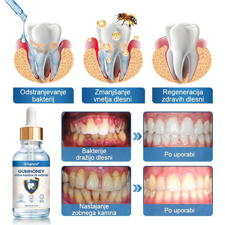 🌿🐝 Gingiora® Oral Heal Drops – naravne kapljice za nego dlesni in ustne votline | Za občutljive, razdražene in krvaveče dlesni ✨🦷