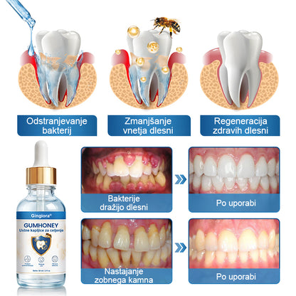 🌿🐝 Gingiora® Oral Heal Drops – naravne kapljice za nego dlesni in ustne votline | Za občutljive, razdražene in krvaveče dlesni ✨🦷