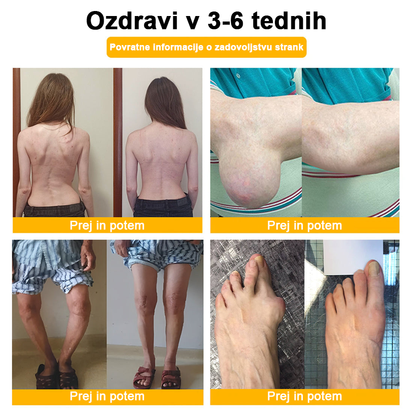 ADNOON™ Krema za lajšanje bolečin in celjenje kosti z botulin toksinom in čebeljim strupom 🦴🐝