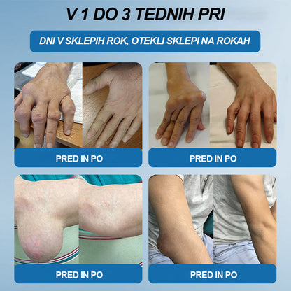 🏆 | Zadnji dan akcije – 80 % POPUST | Twisma® BPC-157 krema za regeneracijo sklepov 🦴 Pomaga pri artritisu, nevropatiji, revmatizmu, športnih poškodbah in drugih težavah 🦵
