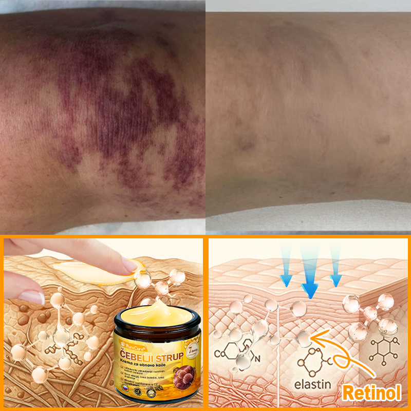 PuraCure® krema za obnovo kože s čebeljim strupom 🐝 | Naravno zdravljenje ekcema, luskavice, dermatitisa in draženja kože | Pomirjujoča in regenerativna formula  🔥