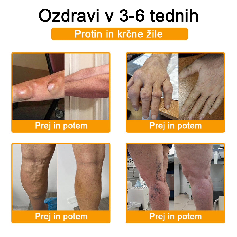 ADNOON™ Krema za lajšanje bolečin in celjenje kosti z botulin toksinom in čebeljim strupom 🦴🐝