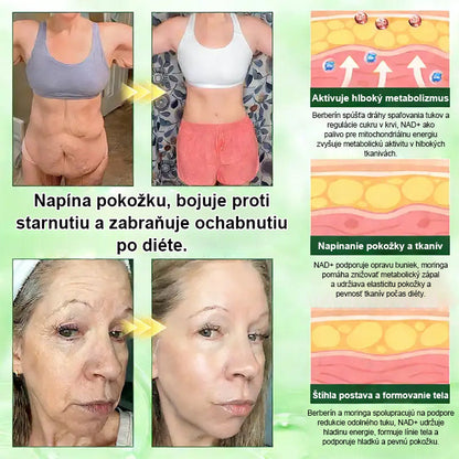 🇸🇰 Auravie® Moringa 10-v-1 Metabolický tvarujúci krém 🌸 | Transdermálna náplasť na podporu regulácie telesnej hmotnosti | Kontrola apetítu 🍽️ | Podpora spaľovania tukov 🔥 | Formovanie a spevnenie tela ✨