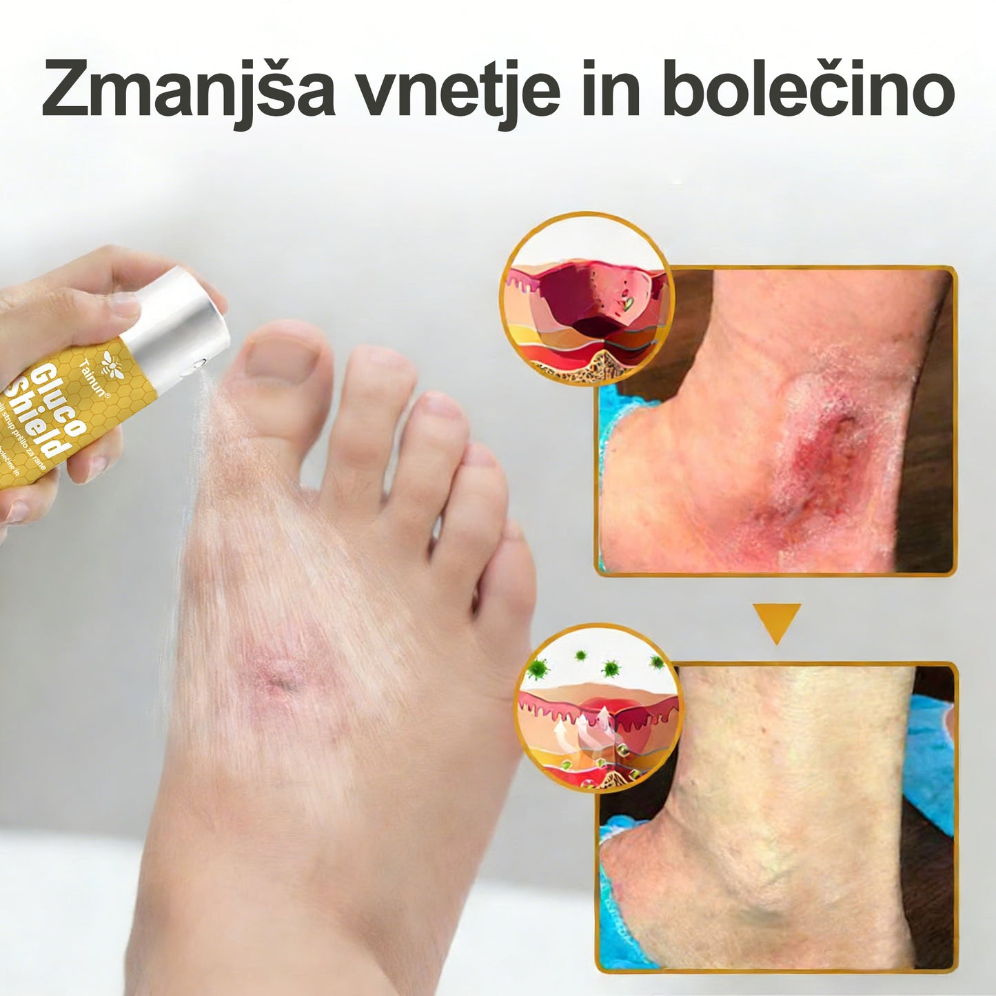 🏆 Najbolj prodajano 🔥 | Tainun® GlucoShield Čebelji strup pršilo za nego ran 🎉 Posebni časovno omejeni popust – ne zamudite!