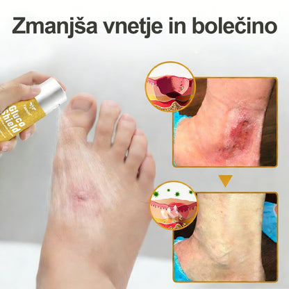 🏆 Najbolj prodajano 🔥 | Tainun® GlucoShield Čebelji strup pršilo za nego ran 🎉 Posebni časovno omejeni popust – ne zamudite!