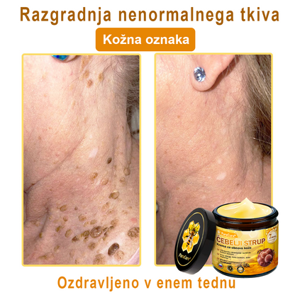PuraCure® krema za obnovo kože s čebeljim strupom 🐝 | Naravno zdravljenje ekcema, luskavice, dermatitisa in draženja kože | Pomirjujoča in regenerativna formula  🔥