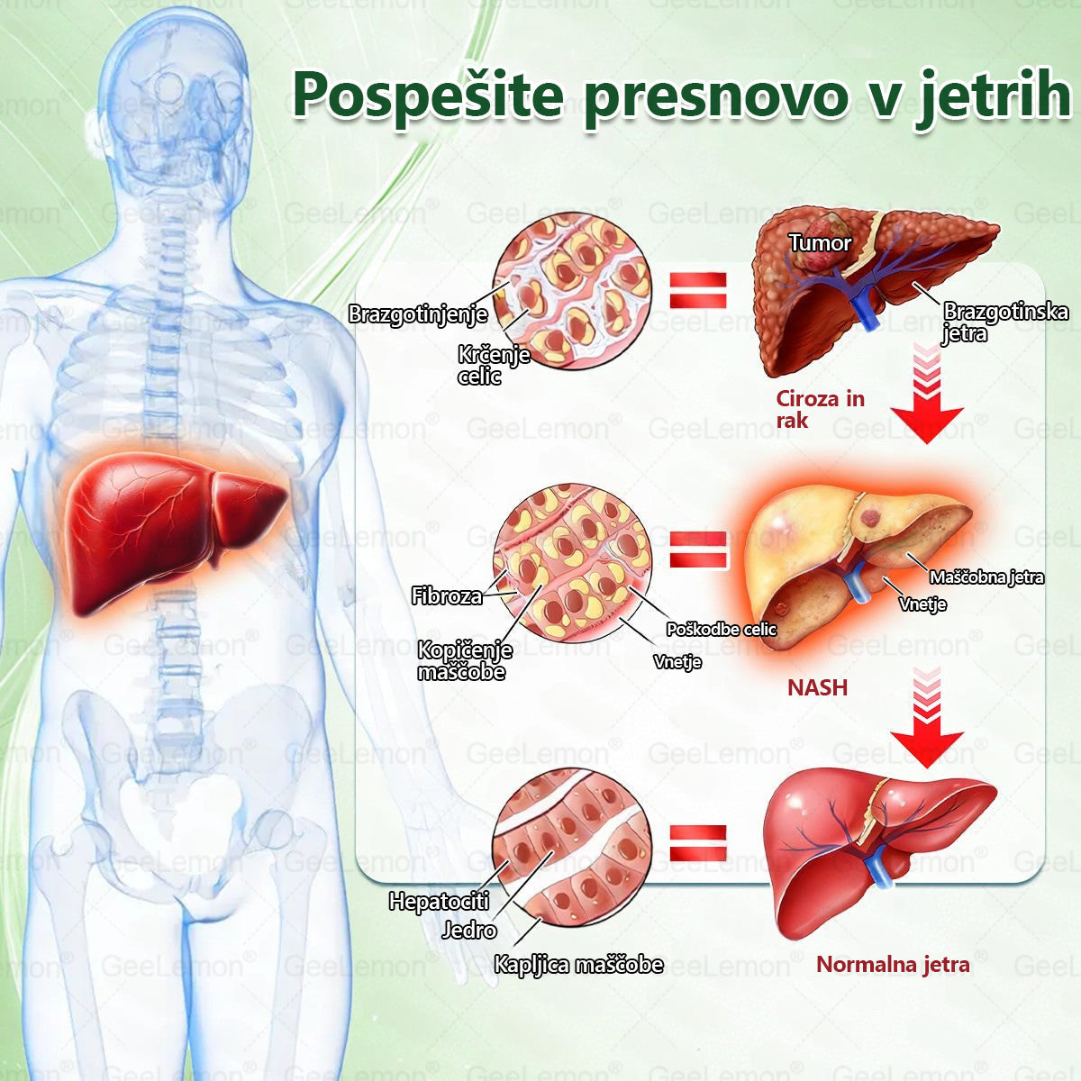 𝐆𝐞𝑒𝐿𝑒𝐦𝐨𝐧® 𝐆𝐥𝐮𝐦𝐚𝐬𝐞𝐭𝐢𝐝𝐞 8 v 1 Hujševalni in zdravju namenjen nano obliž z mikroiglicami 🇸🇮 (Samo enkrat na dan, vidne spremembe že v 7 dneh) ✅