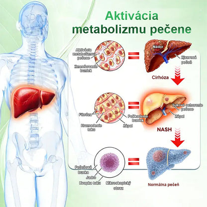 🇸🇰 Auravie® Moringa 10-v-1 Metabolický tvarujúci krém 🌸 | Transdermálna náplasť na podporu regulácie telesnej hmotnosti | Kontrola apetítu 🍽️ | Podpora spaľovania tukov 🔥 | Formovanie a spevnenie tela ✨