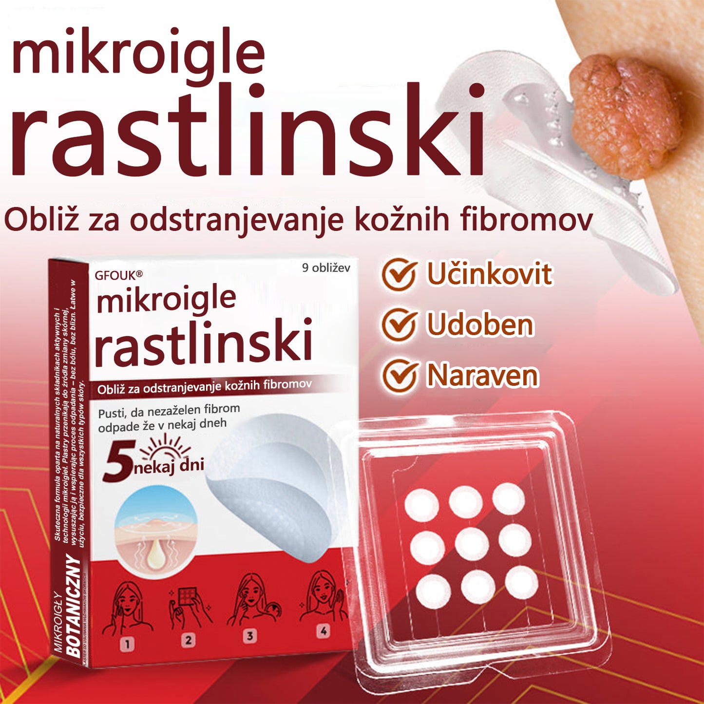 GFOUK® Rastlinski Mikronidling obliži za odstranjevanje kožnih izrastkov✨ – 🩹 Neboleče | 🚫 Brez Brazgotin | 🌿 Naravne Mikroiglice | 🎯 Globinsko Delovanje | 🛡️ Varno za Občutljivo Kožo | 📦 9 kosov | 🇪🇺 Medicinski Razred I |