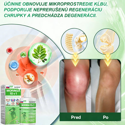 🇸🇰 Auravie® Moringa 10-v-1 Metabolický tvarujúci krém 🌸 | Transdermálna náplasť na podporu regulácie telesnej hmotnosti | Kontrola apetítu 🍽️ | Podpora spaľovania tukov 🔥 | Formovanie a spevnenie tela ✨