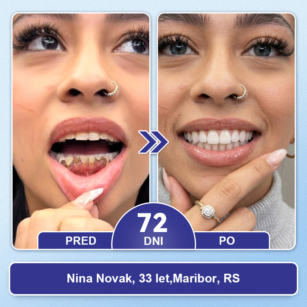 Guxar® Tideglusib Oralni Trakovi 🦷 – Aktivacija matičnih celic🧬, regeneracija dentina💎, krepitev sklenine⚡, beljenje zob✨, zmanjšanje občutljivosti💧, mikronadliki serum za zobe in dlesni💖, nežna vsakodnevna uporaba🌿
