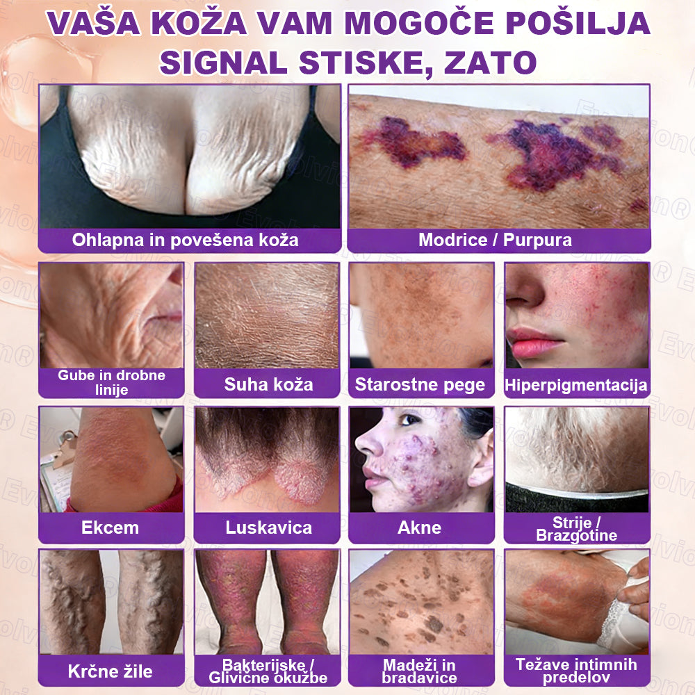 Tainun® Biotin 10-v-1 krema za obnovo kože ✨ proti staranju, luskavici, aknam, brazgotinam, pigmentaciji, suhosti, vnetjem & intimnemu nelagodju 🌿 z naravnimi bioaktivnimi sestavinami 💧 za gladko, čvrsto & mladostno kožo 🌸