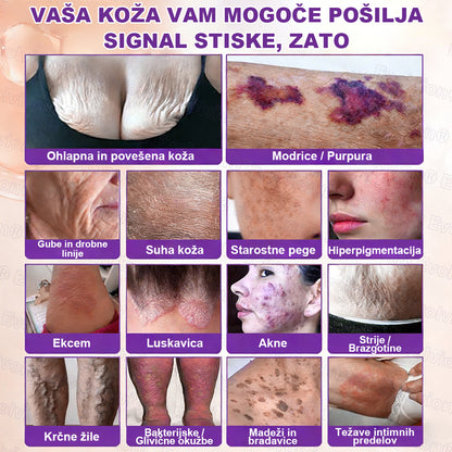 Tainun® Biotin 10-v-1 krema za obnovo kože ✨ proti staranju, luskavici, aknam, brazgotinam, pigmentaciji, suhosti, vnetjem & intimnemu nelagodju 🌿 z naravnimi bioaktivnimi sestavinami 💧 za gladko, čvrsto & mladostno kožo 🌸