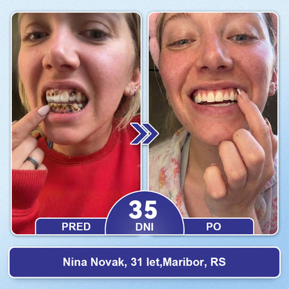 Guxar® Tideglusib Oralni Trakovi 🦷 – Aktivacija matičnih celic🧬, regeneracija dentina💎, krepitev sklenine⚡, beljenje zob✨, zmanjšanje občutljivosti💧, mikronadliki serum za zobe in dlesni💖, nežna vsakodnevna uporaba🌿
