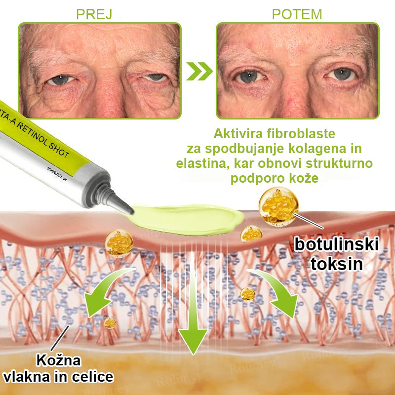 Vosxu™ Botox & Vita-A Retinol Shot serum za lifting gub ✨ – 💉 Mikro-Iglice | 💪 Peptidi z Učinkom Botoksa | 🌿 Retinol | ⚡ Vidni Rezultati v 3 Dneh