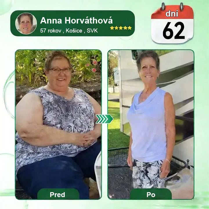 🇸🇰 Auravie® Moringa 10-v-1 Metabolický tvarujúci krém 🌸 | Transdermálna náplasť na podporu regulácie telesnej hmotnosti | Kontrola apetítu 🍽️ | Podpora spaľovania tukov 🔥 | Formovanie a spevnenie tela ✨