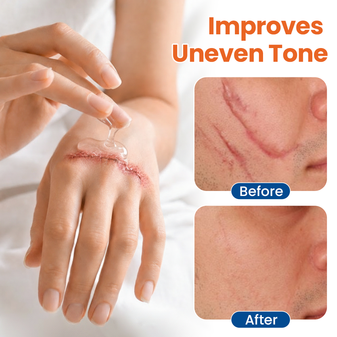 🌟 Vosxu® DermalRebuild Gel za Obnovo Kože – Za Strije, Brazgotine, Akne in Neenakomerno Teksturo | Vidno Bolj Gladka Koža v 7–14 Dneh 💎