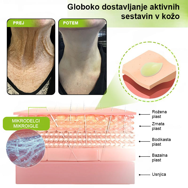 Vosxu™ Botox & Vita-A Retinol Shot serum za lifting gub ✨ – 💉 Mikro-Iglice | 💪 Peptidi z Učinkom Botoksa | 🌿 Retinol | ⚡ Vidni Rezultati v 3 Dneh