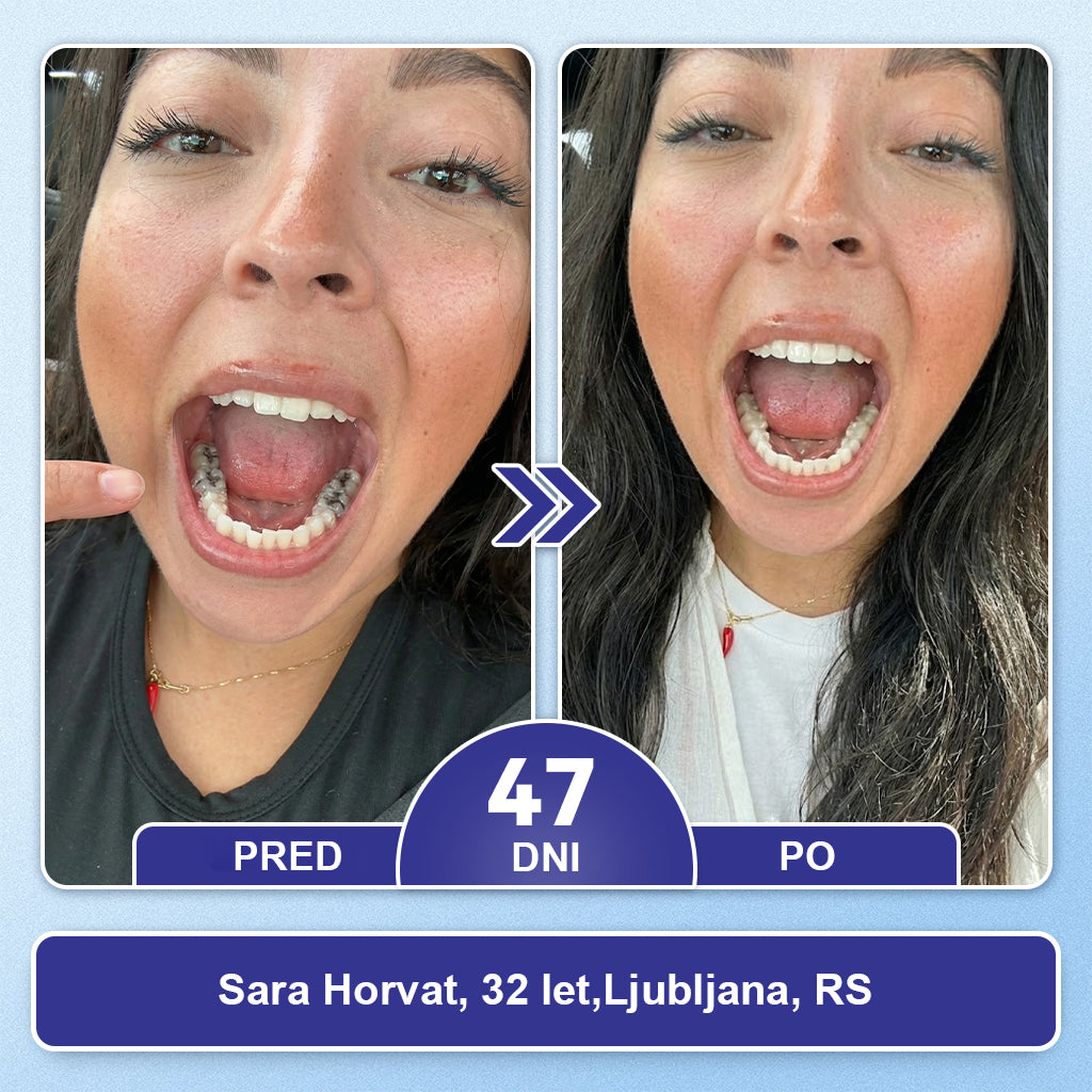 Guxar® Tideglusib Oralni Trakovi 🦷 – Aktivacija matičnih celic🧬, regeneracija dentina💎, krepitev sklenine⚡, beljenje zob✨, zmanjšanje občutljivosti💧, mikronadliki serum za zobe in dlesni💖, nežna vsakodnevna uporaba🌿