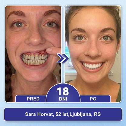 Guxar® Tideglusib Oralni Trakovi 🦷 – Aktivacija matičnih celic🧬, regeneracija dentina💎, krepitev sklenine⚡, beljenje zob✨, zmanjšanje občutljivosti💧, mikronadliki serum za zobe in dlesni💖, nežna vsakodnevna uporaba🌿
