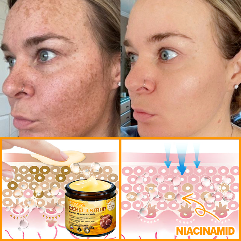 PuraCure® krema za obnovo kože s čebeljim strupom 🐝 | Naravno zdravljenje ekcema, luskavice, dermatitisa in draženja kože | Pomirjujoča in regenerativna formula  🔥