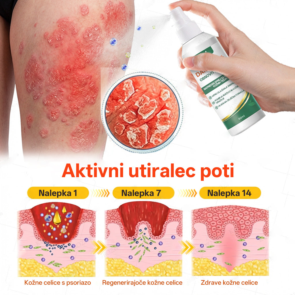 ✨ Rilua® 24H Tag- & Nacht Psoriasis System ✨ 🌿 Steroidfrei | ⚡ Anti-Juckreiz Soforthilfe Spray + 🛡️ Reparatur Balsam 💆‍♀️ Für Kopfhaut & Körper | 🔬 Dermatologisch entwickelt | 🚀 Schnelle Wirkung