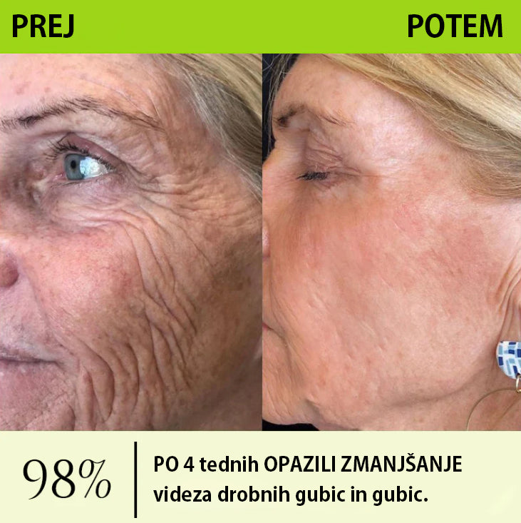 Vosxu™ Botox & Vita-A Retinol Shot serum za lifting gub ✨ – 💉 Mikro-Iglice | 💪 Peptidi z Učinkom Botoksa | 🌿 Retinol | ⚡ Vidni Rezultati v 3 Dneh