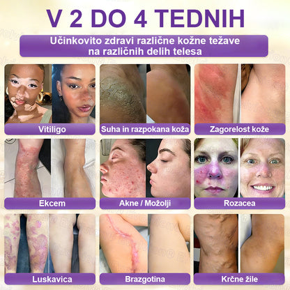 Tainun® Biotin 10-v-1 krema za obnovo kože ✨ proti staranju, luskavici, aknam, brazgotinam, pigmentaciji, suhosti, vnetjem & intimnemu nelagodju 🌿 z naravnimi bioaktivnimi sestavinami 💧 za gladko, čvrsto & mladostno kožo 🌸