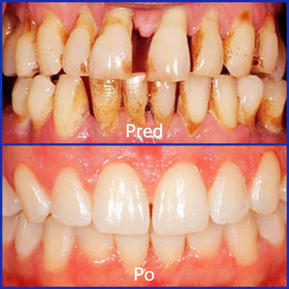 🌟 Twisma® VioCore Propolis zobna pasta 🦷 Olajšanje zobobola v 3 dneh · 7-dnevna obnova dlesni · Preprečevanje parodontalne bolezni · Popolna kombinacija čebeljega strupa in naravnih mineralov 🌟
