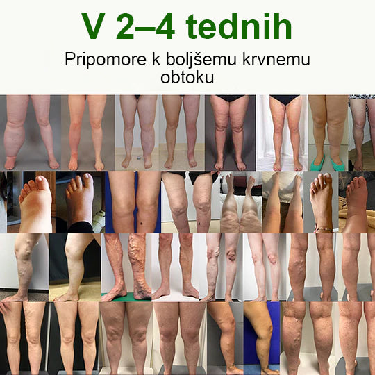 Poslovite se od otečenih, bolečih nog – Healrize® FluidEase Professional Krema za cirkulacijo nog prinaša pravo olajšanje! 🦵