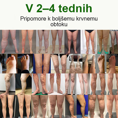 Poslovite se od otečenih, bolečih nog – Healrize® FluidEase Professional Krema za cirkulacijo nog prinaša pravo olajšanje! 🦵