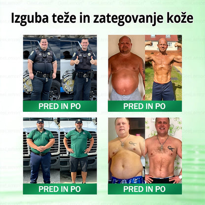 𝐆𝐞𝑒𝐿𝑒𝐦𝐨𝐧® 𝐆𝐥𝐮𝐦𝐚𝐬𝐞𝐭𝐢𝐝𝐞 8 v 1 Hujševalni in zdravju namenjen nano obliž z mikroiglicami 🇸🇮 (Samo enkrat na dan, vidne spremembe že v 7 dneh) ✅