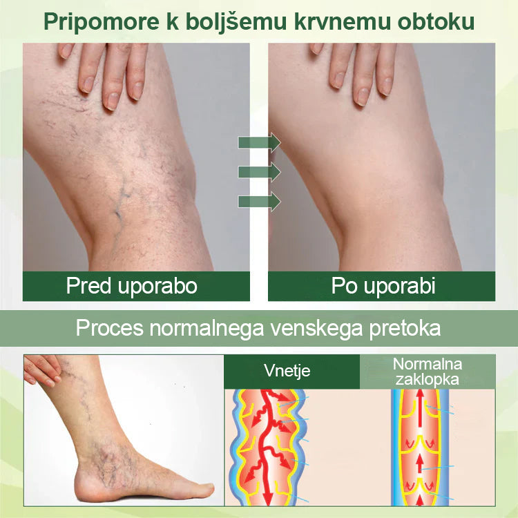 Poslovite se od otečenih, bolečih nog – Healrize® FluidEase Professional Krema za cirkulacijo nog prinaša pravo olajšanje! 🦵