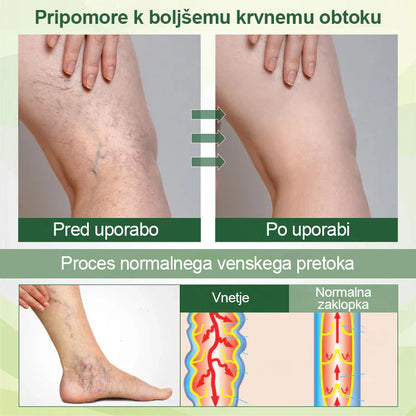 Poslovite se od otečenih, bolečih nog – Healrize® FluidEase Professional Krema za cirkulacijo nog prinaša pravo olajšanje! 🦵
