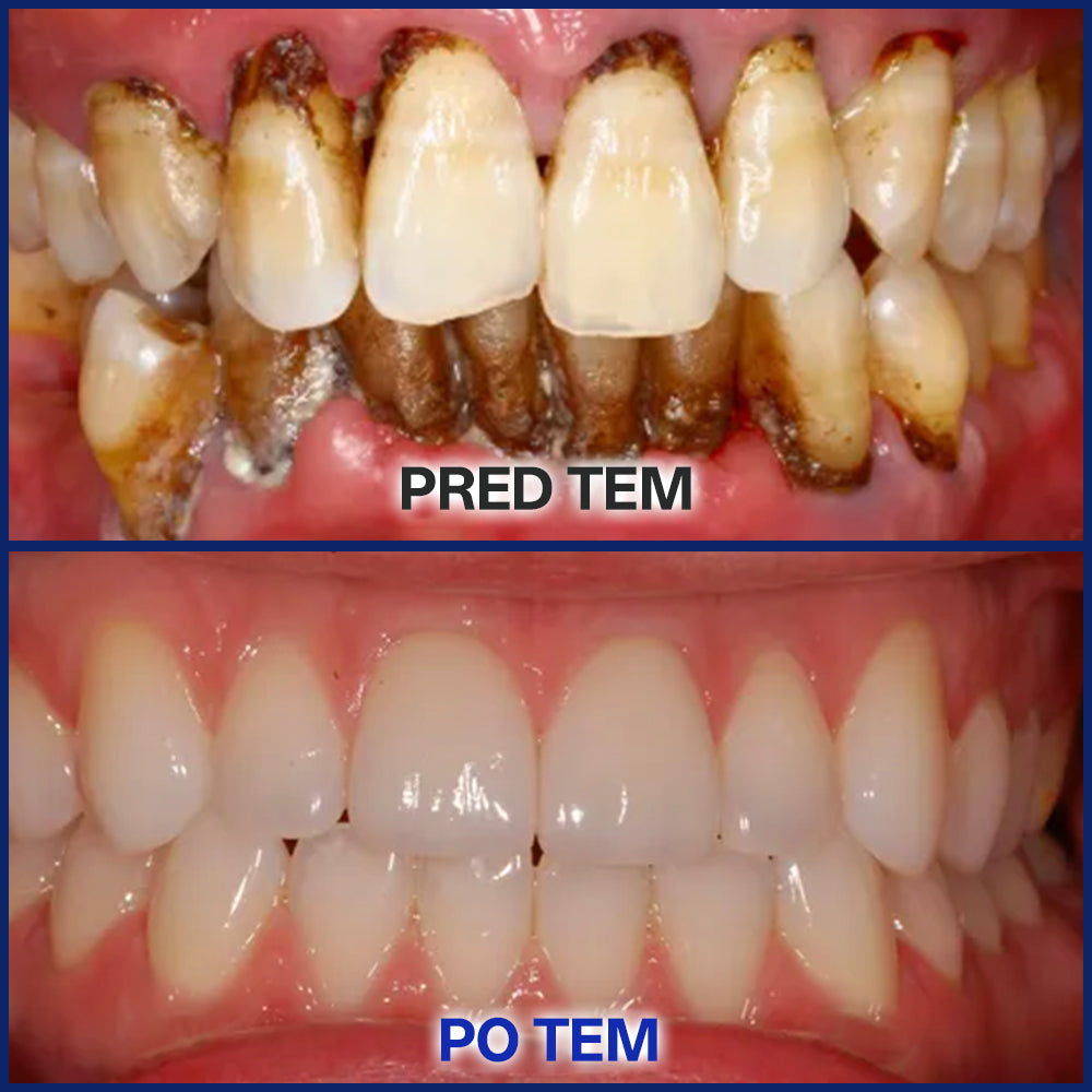 Rtmoy® BeeTakt kapljice za nego zob s čebeljim strupom – napredna rešitev za obnovo dlesni in ustno zdravje 🦷 | odstranjevanje zobnih oblog, regeneracija dlesni in lajšanje občutljivosti