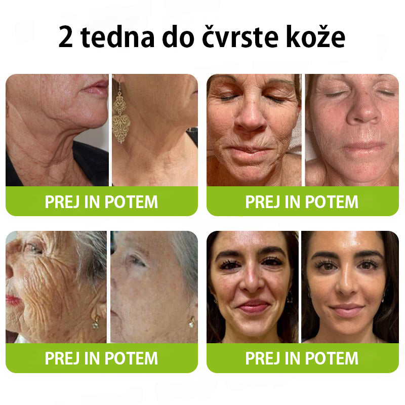 Vosxu™ Botox & Vita-A Retinol Shot serum za lifting gub ✨ – 💉 Mikro-Iglice | 💪 Peptidi z Učinkom Botoksa | 🌿 Retinol | ⚡ Vidni Rezultati v 3 Dneh