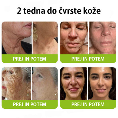 Vosxu™ Botox & Vita-A Retinol Shot serum za lifting gub ✨ – 💉 Mikro-Iglice | 💪 Peptidi z Učinkom Botoksa | 🌿 Retinol | ⚡ Vidni Rezultati v 3 Dneh